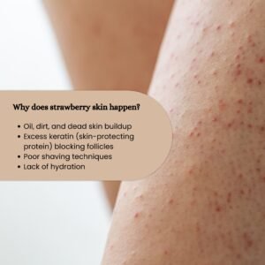 Strawberry skin keratosis pilaris