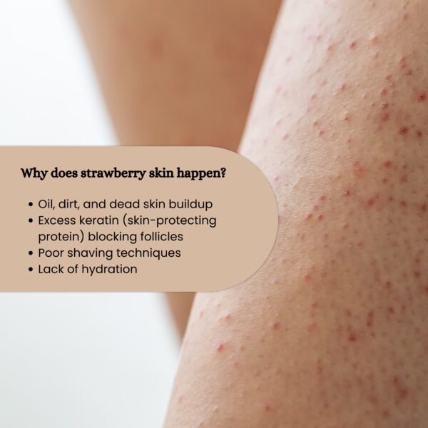 Strawberry skin keratosis pilaris